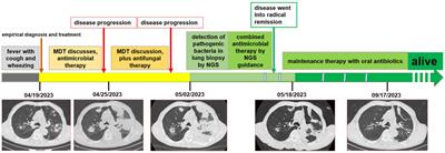 Metagenome next-generation sequencing plays a key role in the diagnosis and selection of effective antibiotics on the treatment of Nocardia pneumonia: a case report